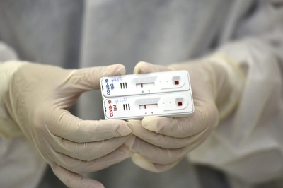 Coronavírus: Jundiaí inicia testagem ampla, acima das médias do Brasil e da Alemanha